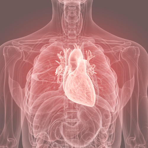 lymphocytic myocarditis inflammation